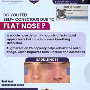 Dr rahul dalal is the Best plastic surgeon in Pune.visit now.