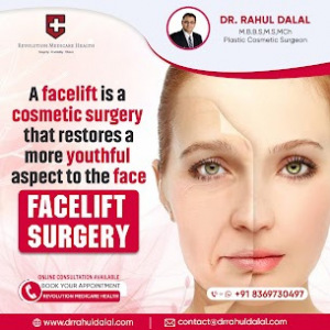 Facelift
