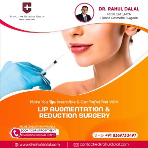 Lip-Augmentation-scaled