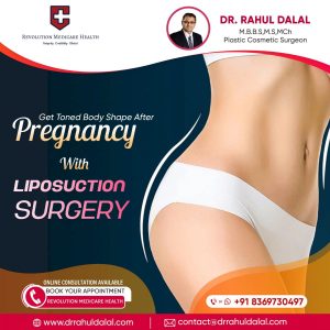 Liposuction-scaled