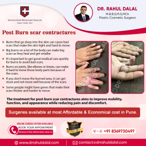 RAHUL-DALAL-SOCIAL-MEDIA-POST-OF-From-Injury-to-Transformation-Post-Trauma-Ear-Pinna-Injuries-Repair-copy