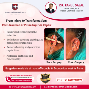 RAHUL-DALAL-SOCIAL-MEDIA-POST-OF-From-Injury-to-Transformation-Post-Trauma-Ear-Pinna-Injuries-Repair