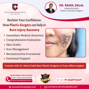 RAHUL-DALAL-SOCIAL-MEDIA-POST-OF-Reclaim-Your-Confidence-How-Plastic-Surgery-can-help-in-Burn-Injury-Recovery