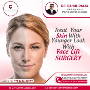 RAHUL-DALAL-Social-Media-Post-Of-Face-lift-Surgery-1-scaled