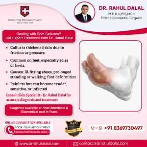 Rahul-Dalal-Social-Media-post-of-Foot-Calluses