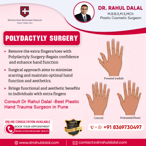 Rahul-Dalal-Social-Media-post-of-Polydactyly-Surgery