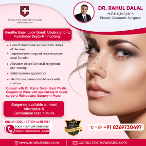 Rahul-Dalal-Social-Media-post-of-Septo-Rhinoplasty-1