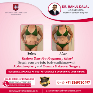 Rahul-Dalal-Social-Media-post-of-mommy-makeover-surgery.