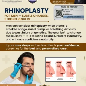 Rhinoplasty-For-Men-In-Pune