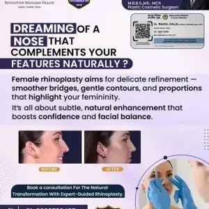 Rhinoplasty-for-women-cosmetic-Surgery-In-Pune