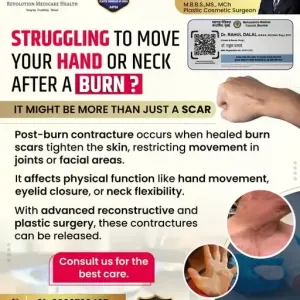 Skin-Burn-Surgery-In-Pune