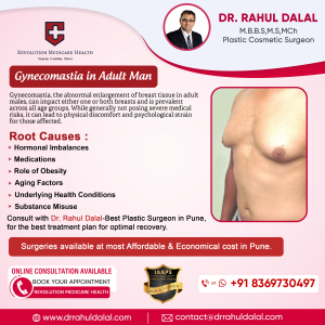 dr-Rahul-Dalal-Social-Media-Post-of-Gynecomastia-in-adult-man