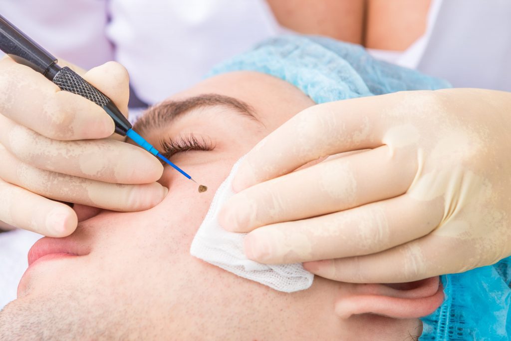 surgical dermatology