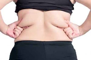 Bra And Back Liposuction