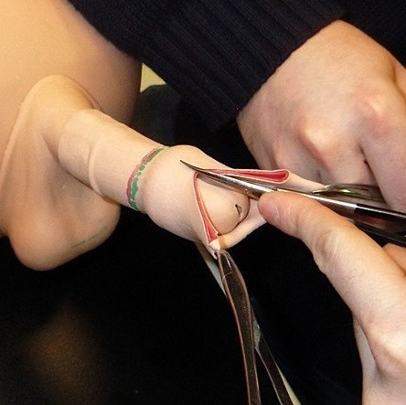 male-circumcision