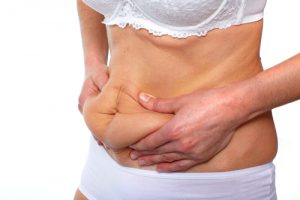 mini tummy tuck surgery