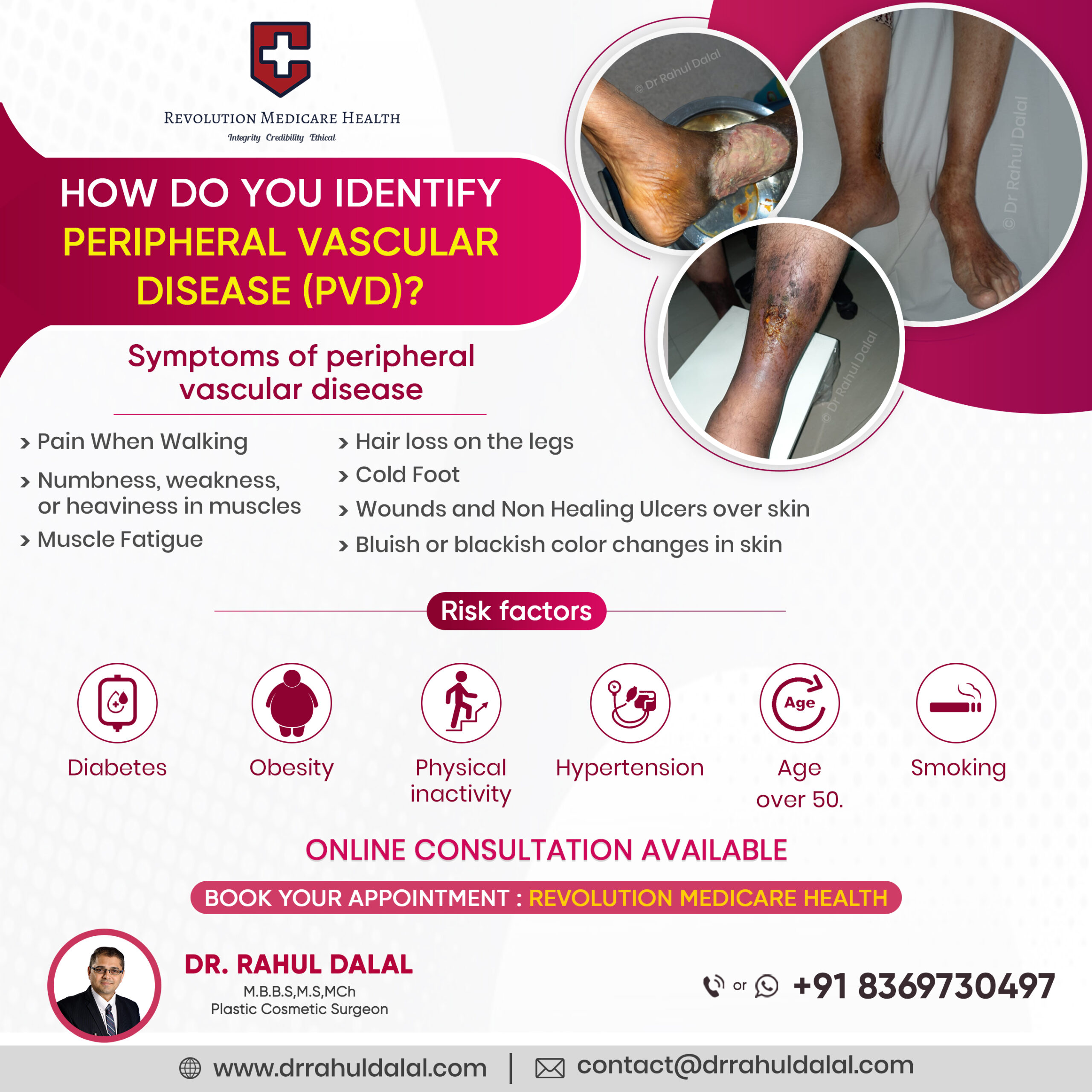 Best microvascular reconstructive surgery In Pune-Dr.Rahul Dalal