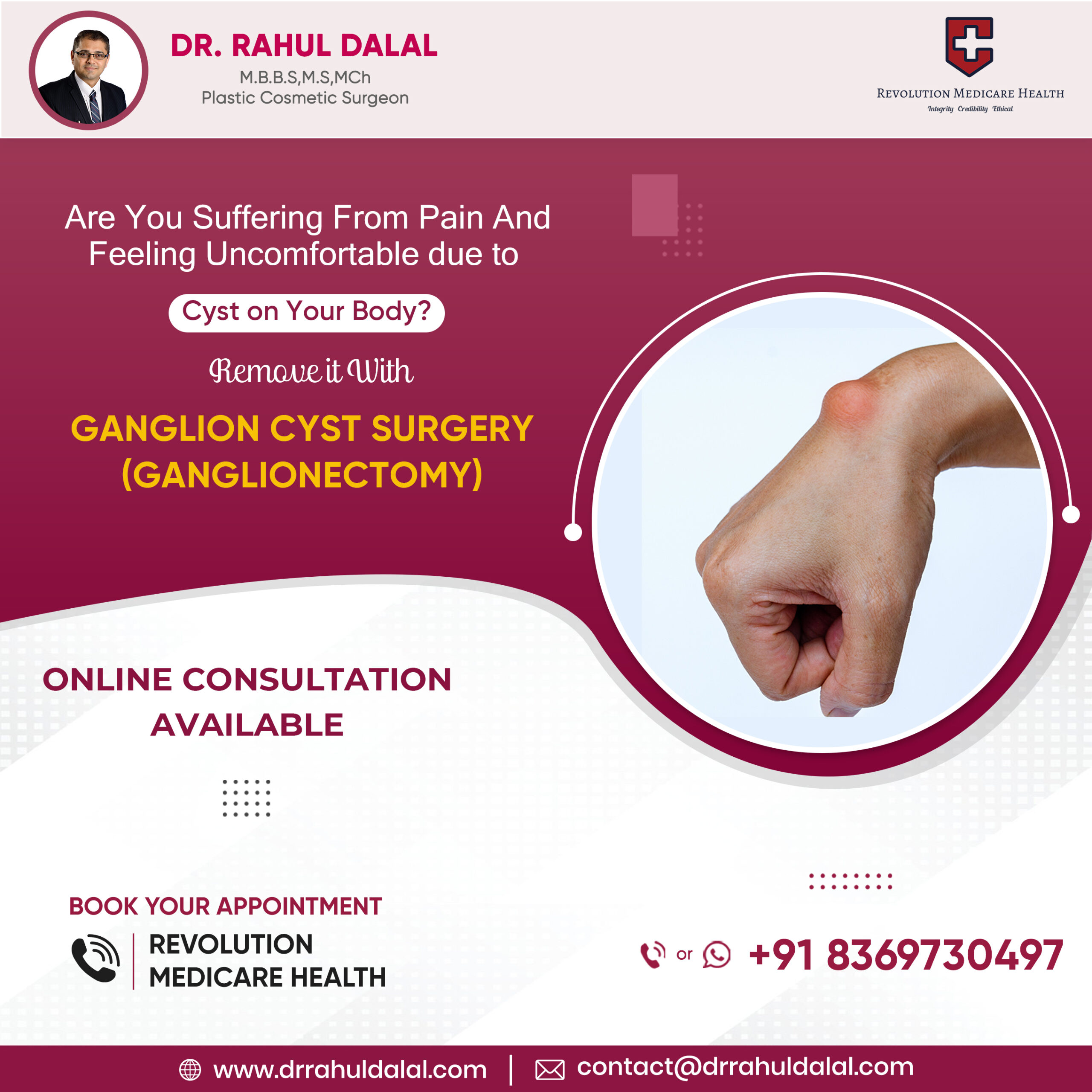 Ganglion Surgery